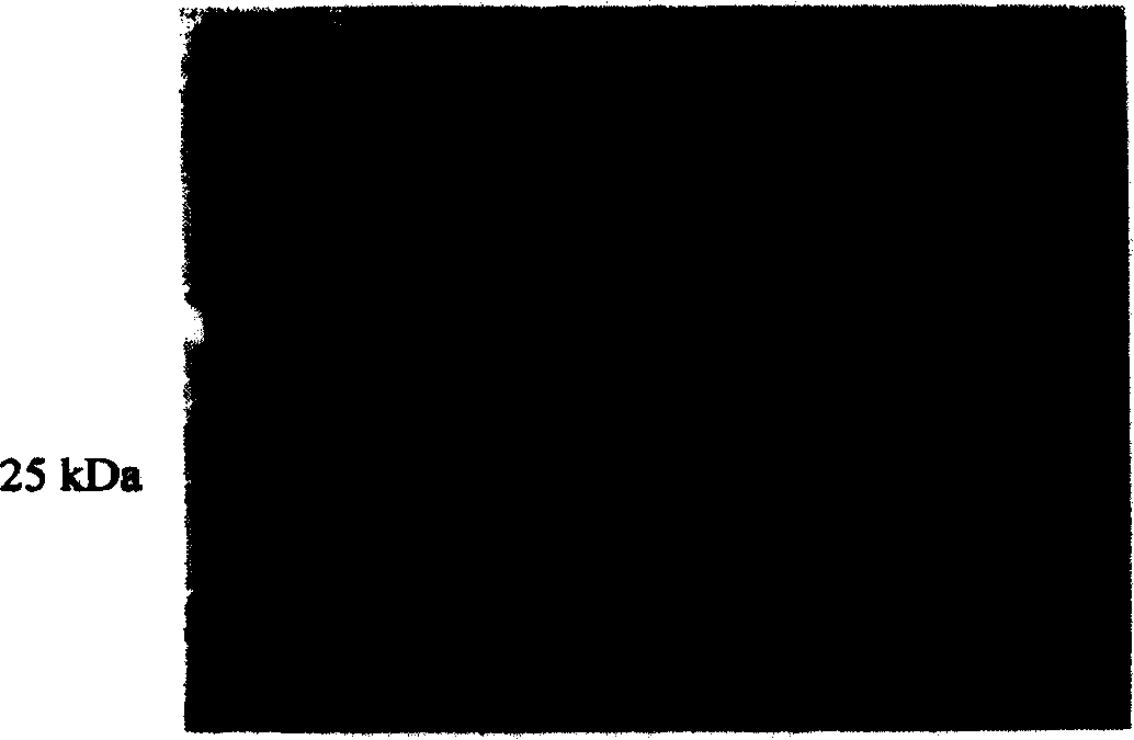 Gene of expressing regeneration enhancement factor of recombined human liver in full lenght, and method for preparing regeneration enhancement factor of recombined human liver in full length, and use