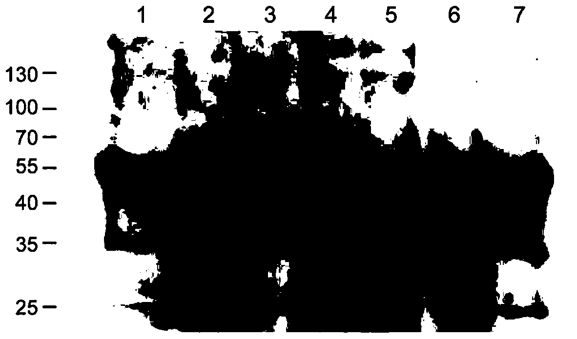 Mutant of human papilloma virus 68 type L1 protein