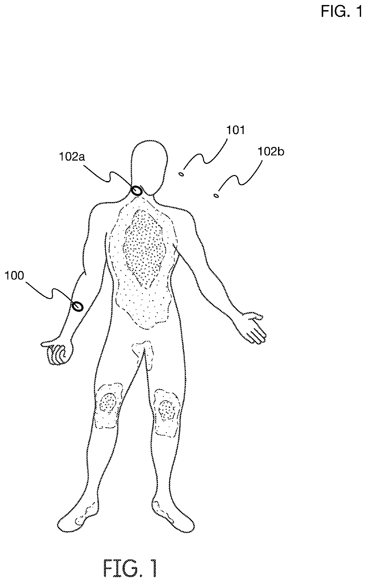 Wearable phototherapy apparatus with Anti-viral and other effects