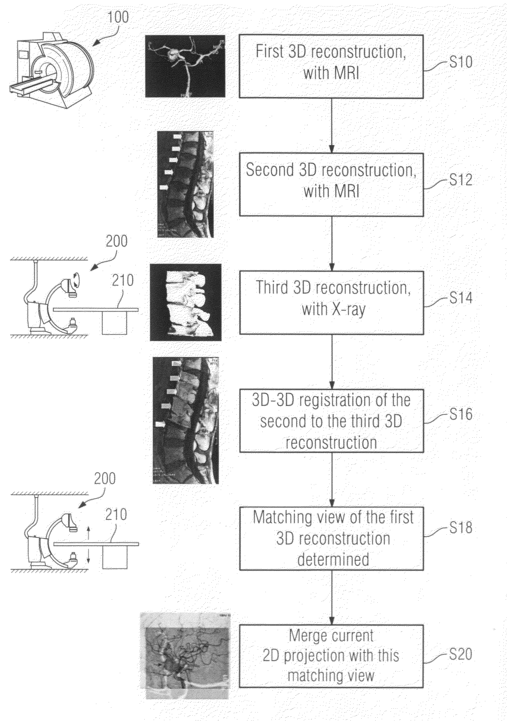 Method for image registration processes and X-ray angiography system