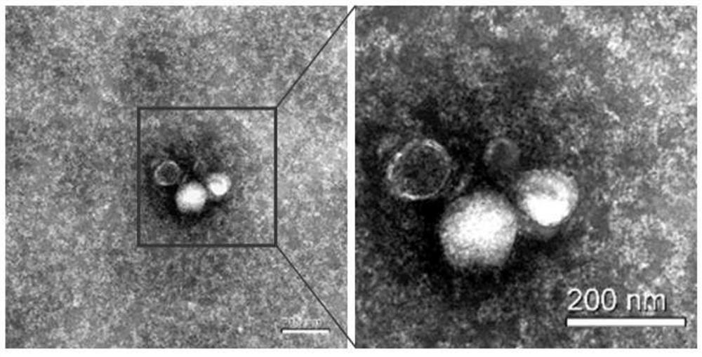 Preparation of exosomes from dental epithelial cells, preparation and application of exosome implants