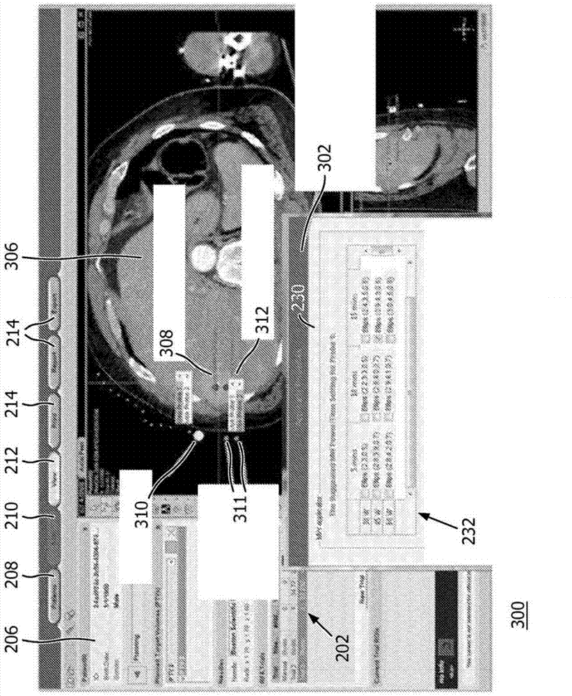 Ablation planning system