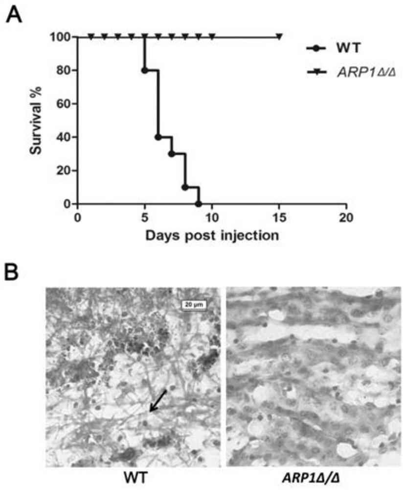 Candida albicans attenuated strain with deletion of ARP1 gene and application of candida albicans attenuated strain