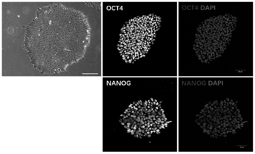 A neural crest lineage pericyte derived from pluripotent stem cells and its differentiation method