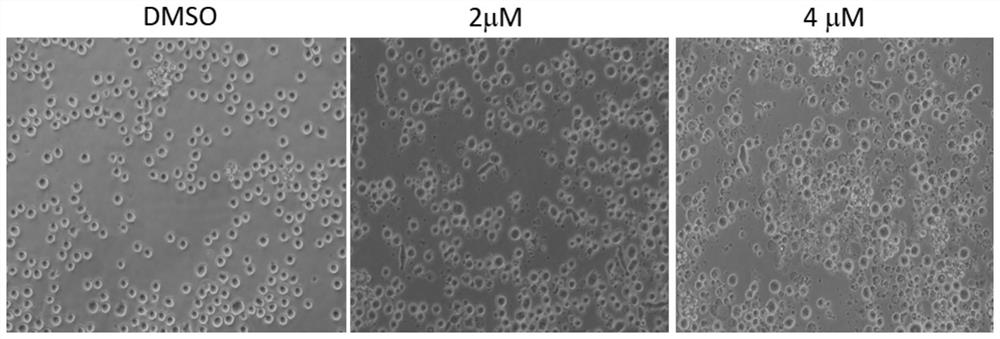 Application of RNA helicase DHX33 inhibitor in preparation of medicine for treatment of leukemia