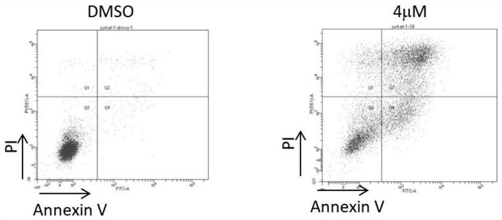 Application of RNA helicase DHX33 inhibitor in preparation of medicine for treatment of leukemia