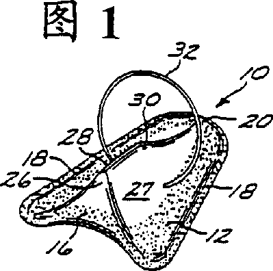 Urinary incontinence device