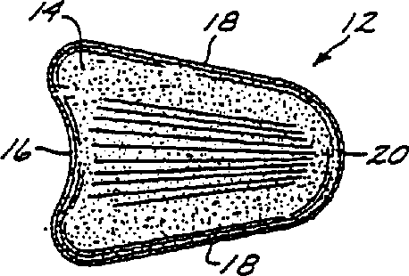 Urinary incontinence device