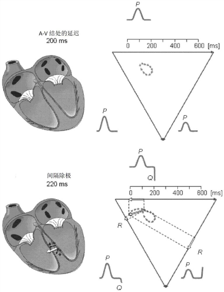 Microelectronic sensors for non-invasive monitoring of physiological parameters