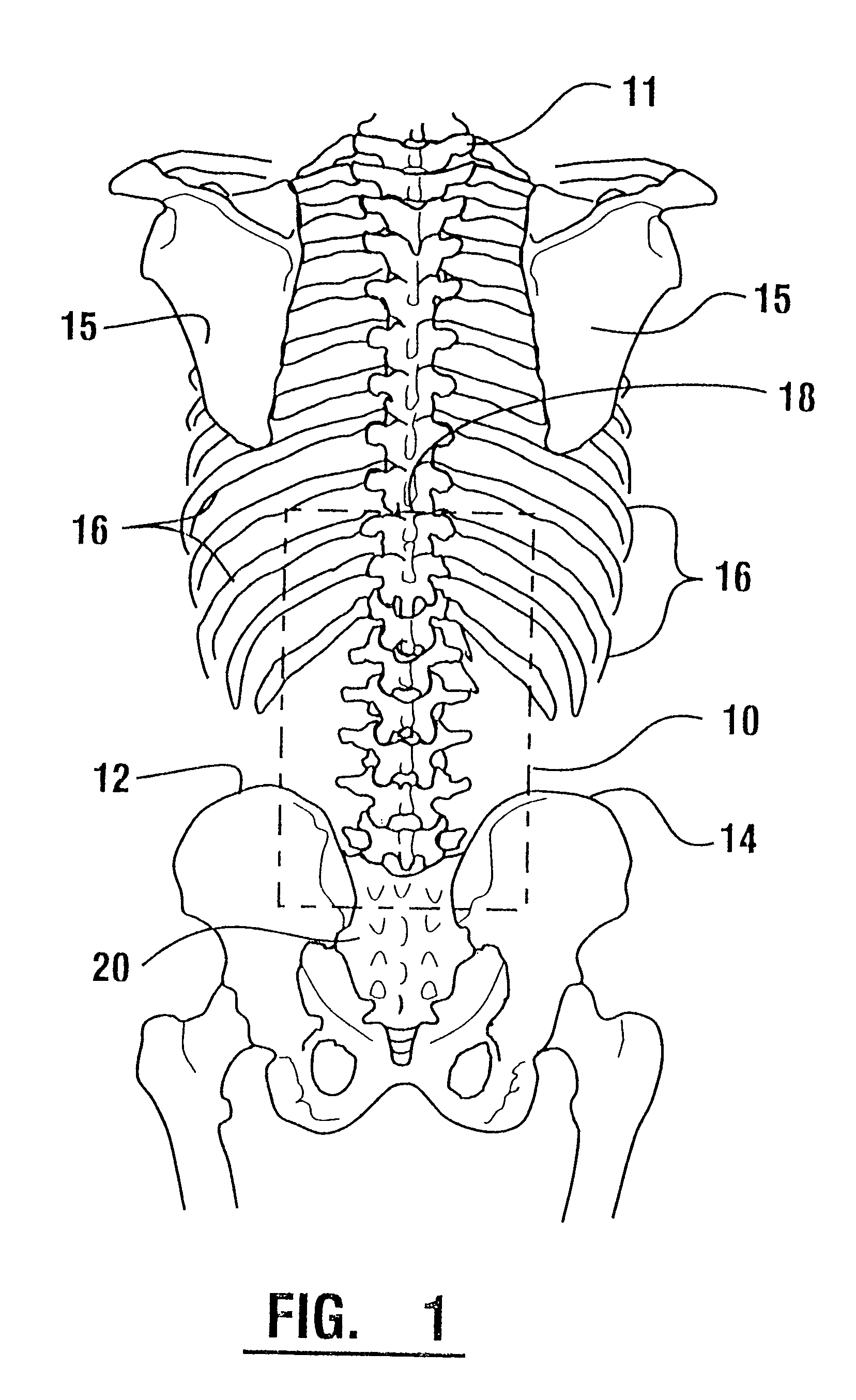 EMG electrode apparatus and positioning system