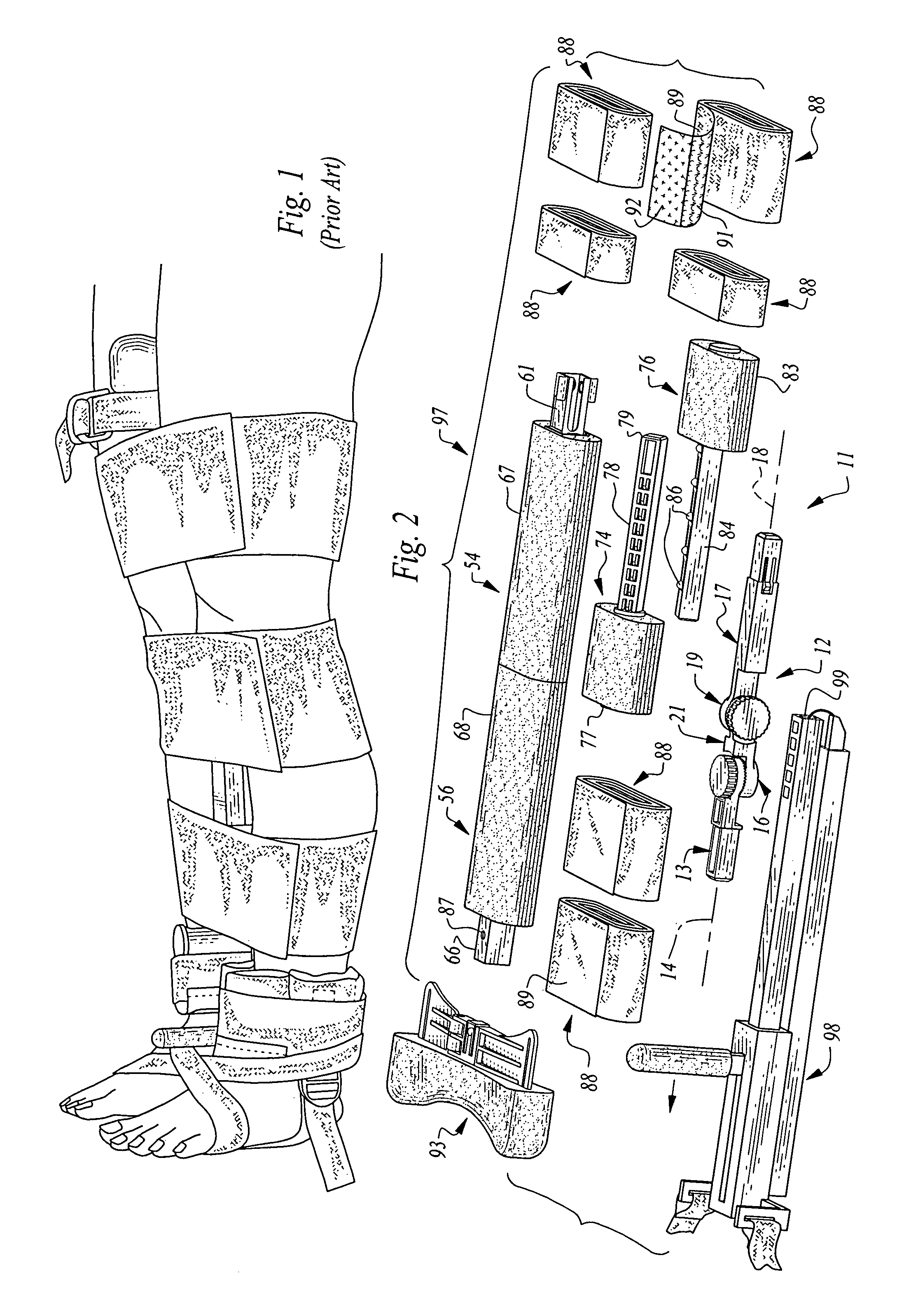 Medical splinting apparatus and methods for using the same