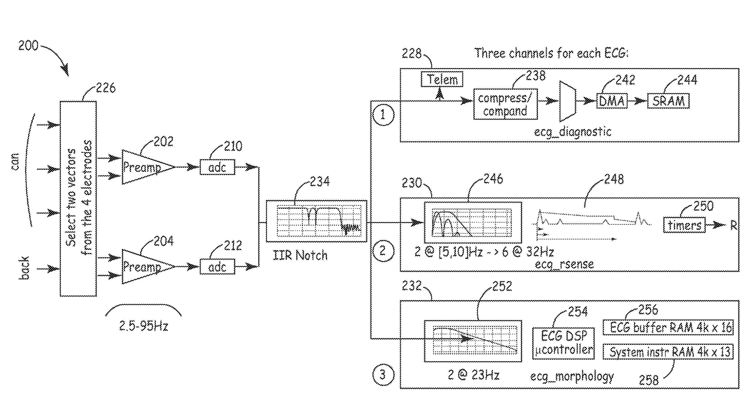 Method and apparatus for detecting arrhythmias in a subcutaneous medical device