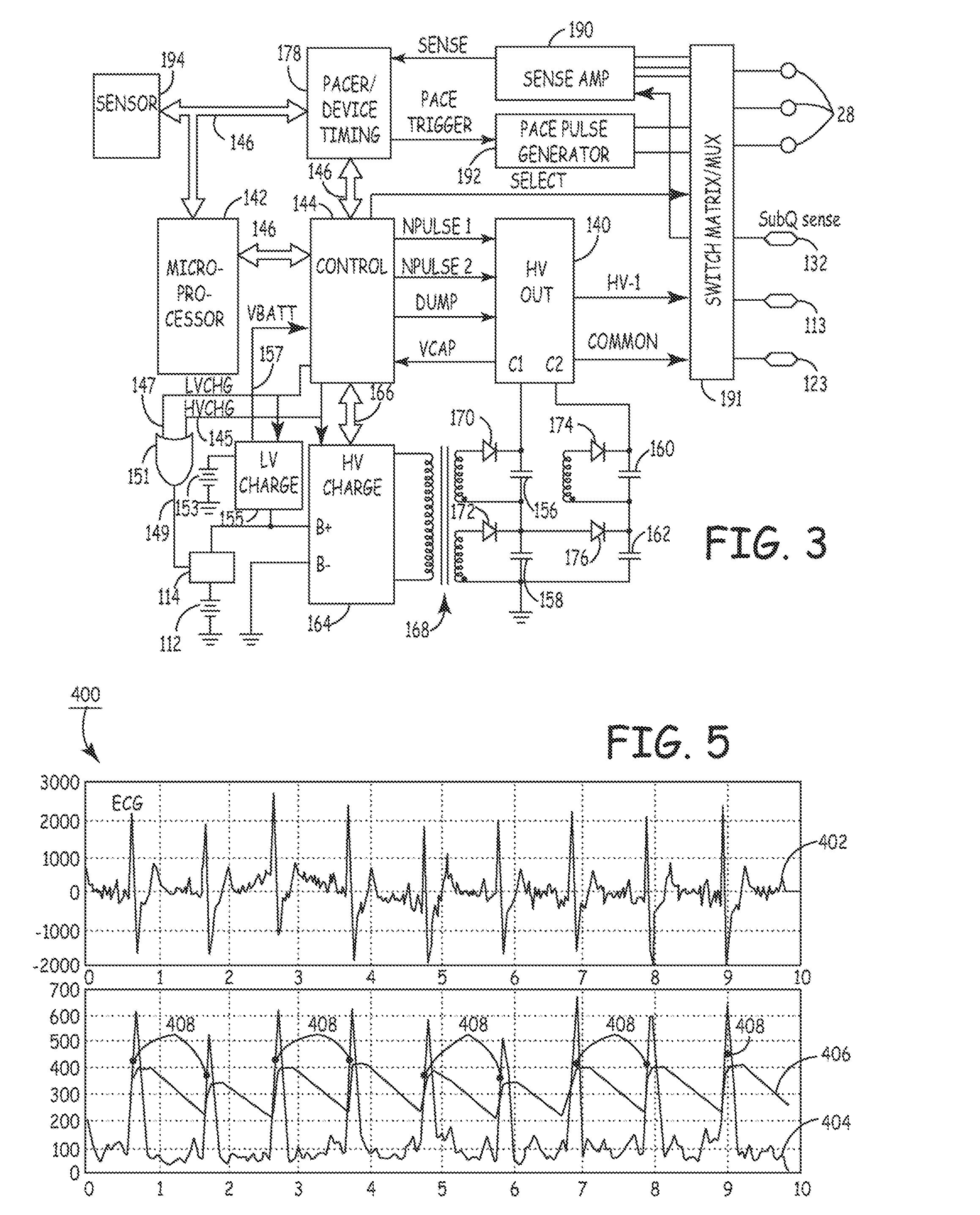 Method and apparatus for detecting arrhythmias in a subcutaneous medical device