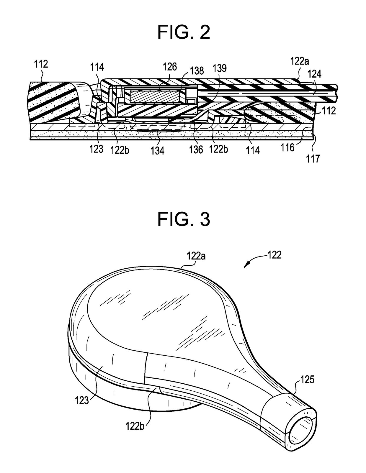 Patch and sensor assembly for use in medical device localization and mapping systems