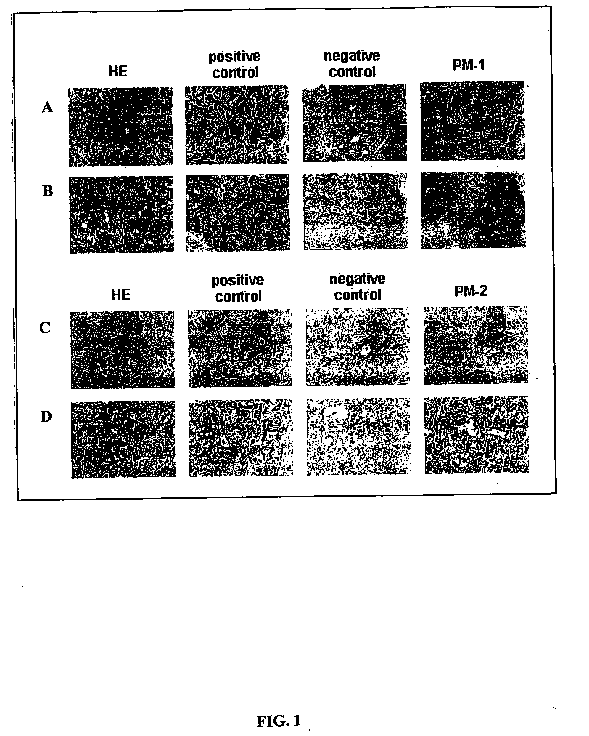 Neoplasm specific antibodies and uses thereof