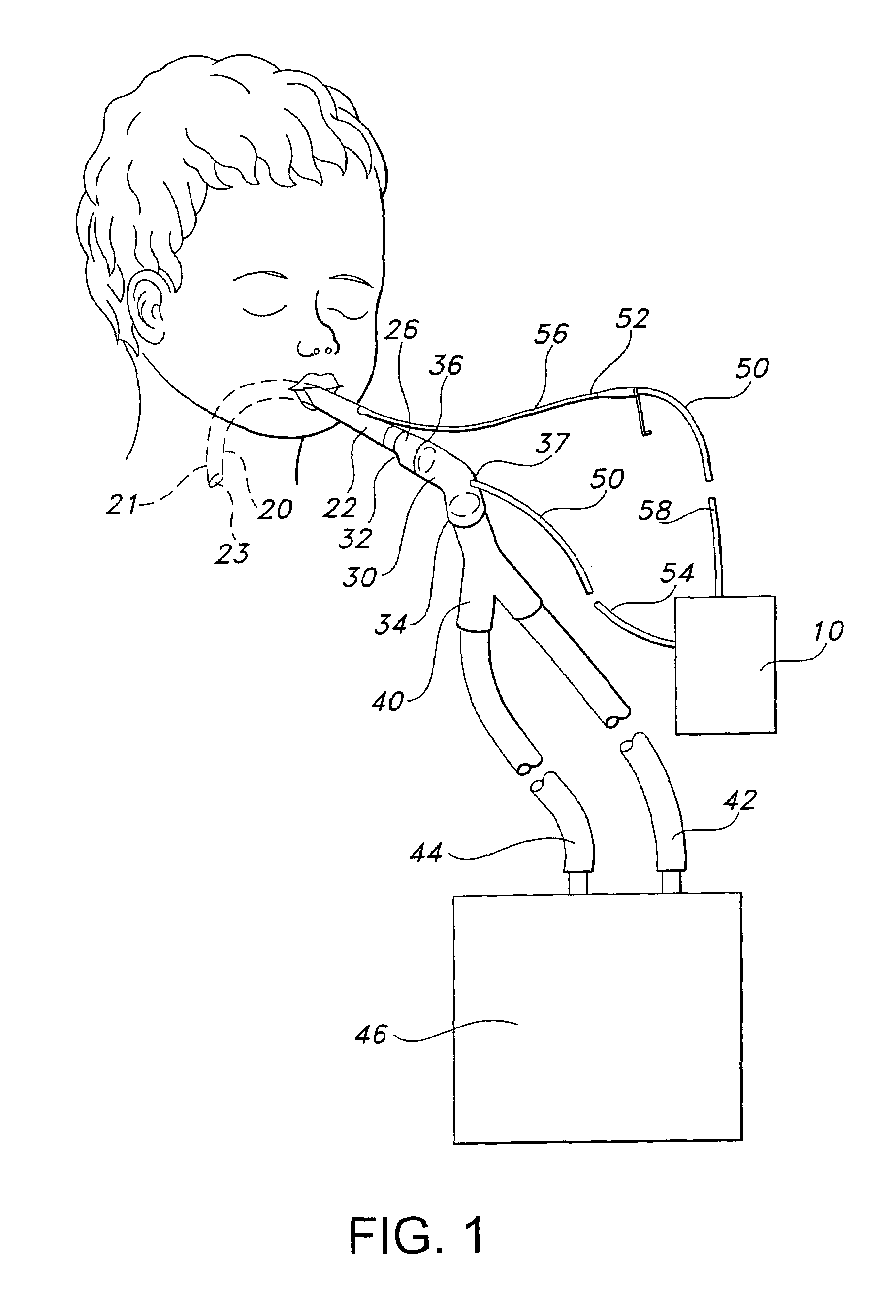 Endotracheal tube pressure monitoring system and method of controlling same