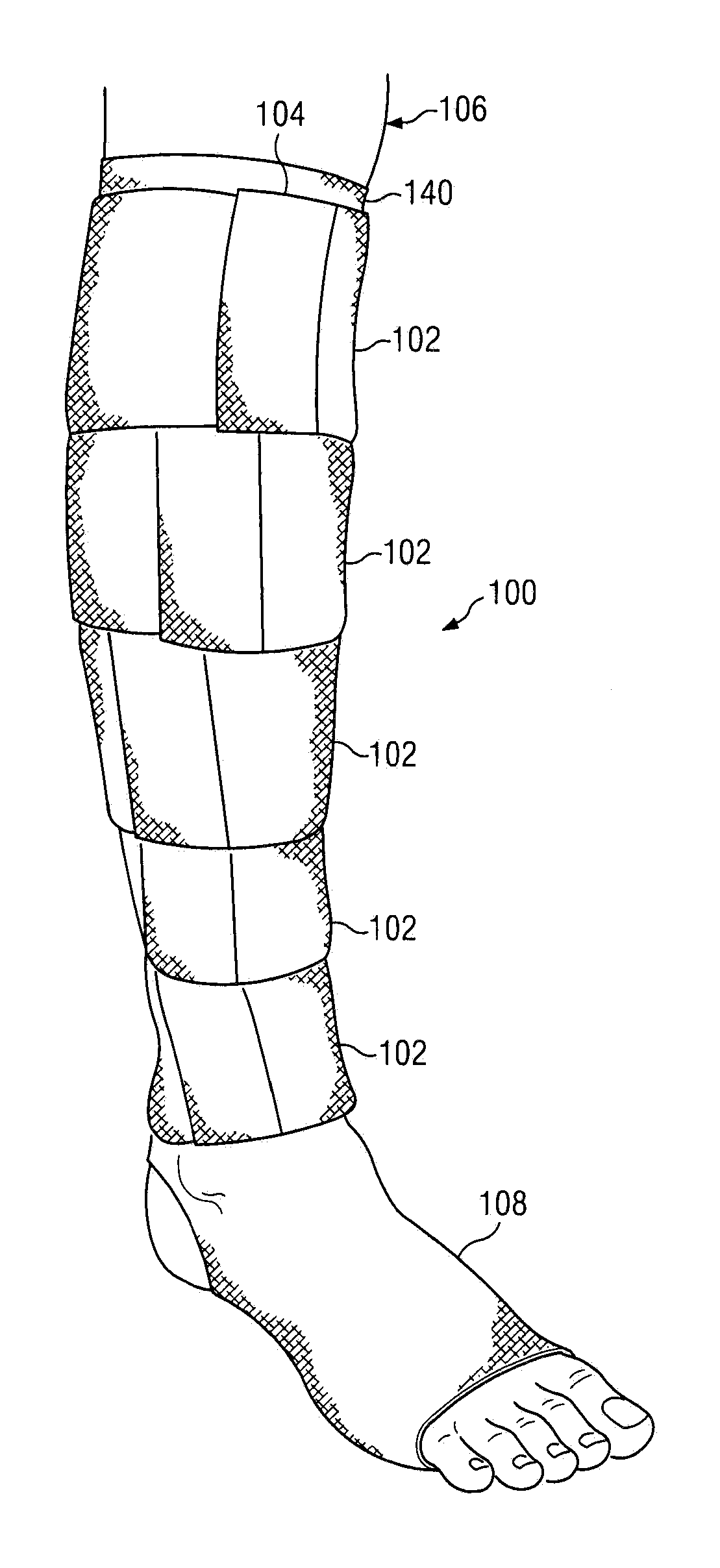 Hybrid compression stocking