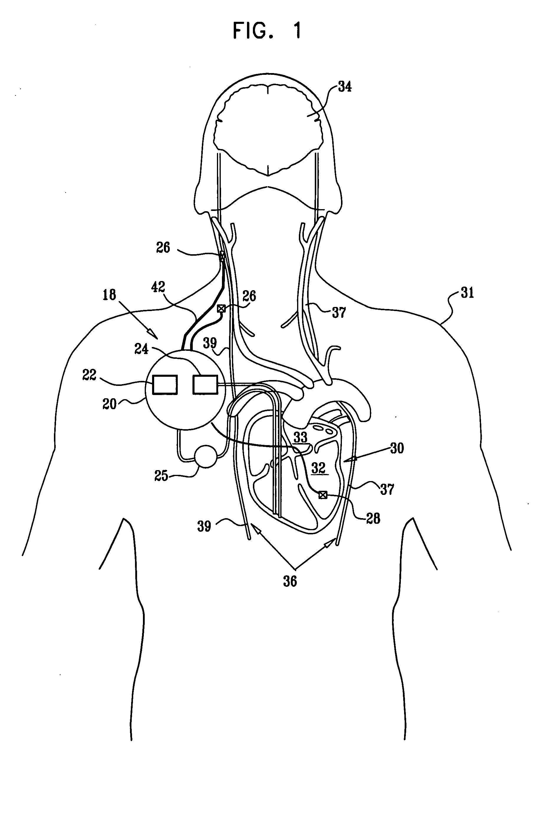 Techniques for applying, calibrating, and controlling nerve fiber stimulation