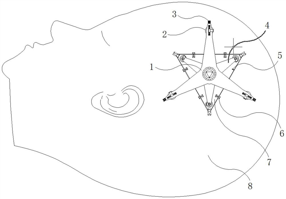 A cranial repositioner with a splint