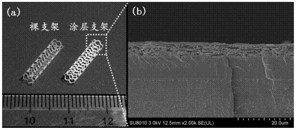 A kind of cardiovascular stent coating based on double-layer heterogeneous structure and preparation method thereof
