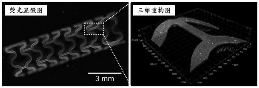 A kind of cardiovascular stent coating based on double-layer heterogeneous structure and preparation method thereof