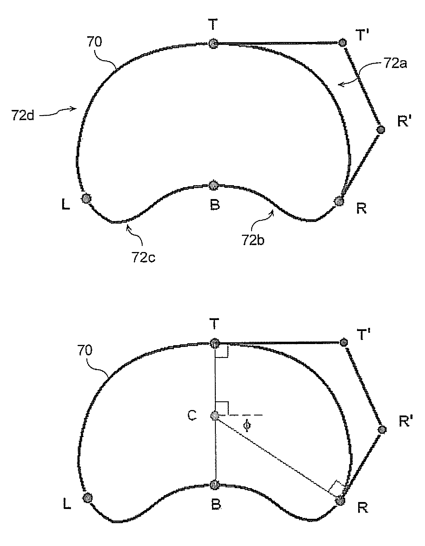 System and method for segmenting a region in a medical image