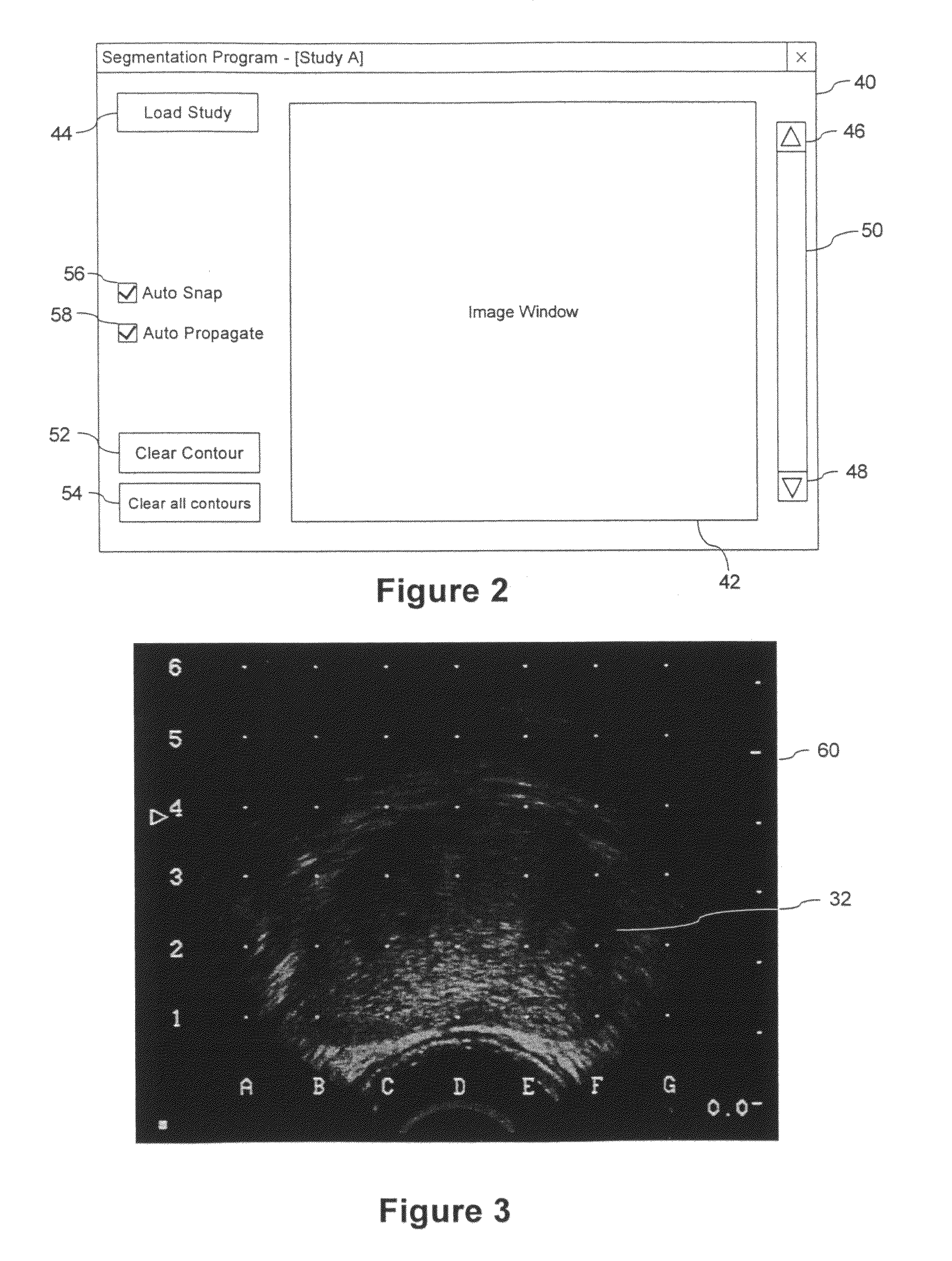 System and method for segmenting a region in a medical image