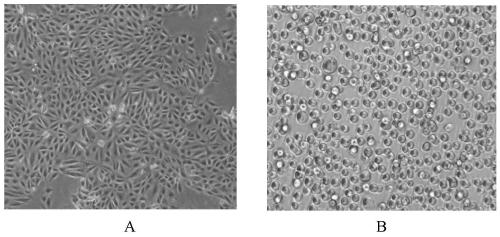 Serum-free suspension culture type MDCK cell strain and application thereof