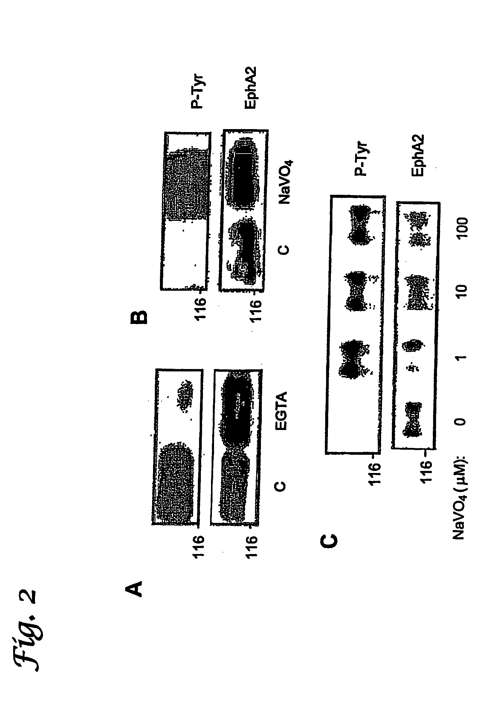 EphA2, EphA4 and LMW-PTP and methods of treatment of hyperproliferative cell disorders