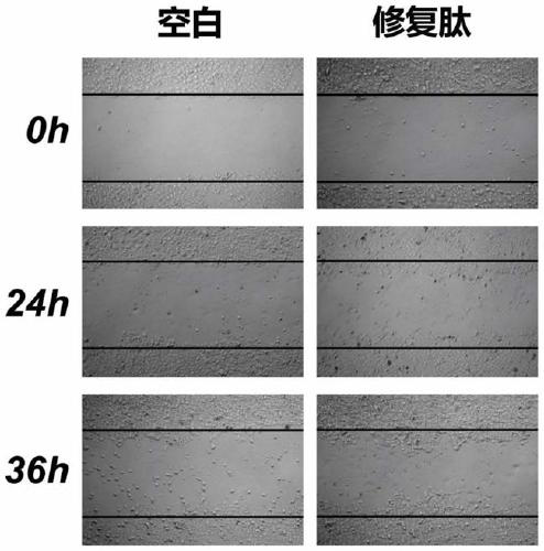 Drosophila melanogaster polypeptide for promoting tissue repair as well as preparation method and application thereof