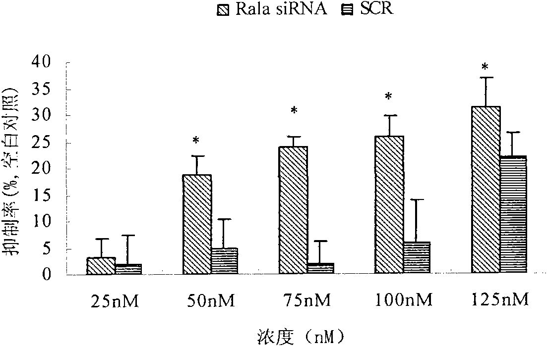 Application of small interfering RNA (Ribonucleic Acid) of RALA (v-ral simian leukemia viral oncogene homolog A) gene in preparing medicaments for resisting leukemia
