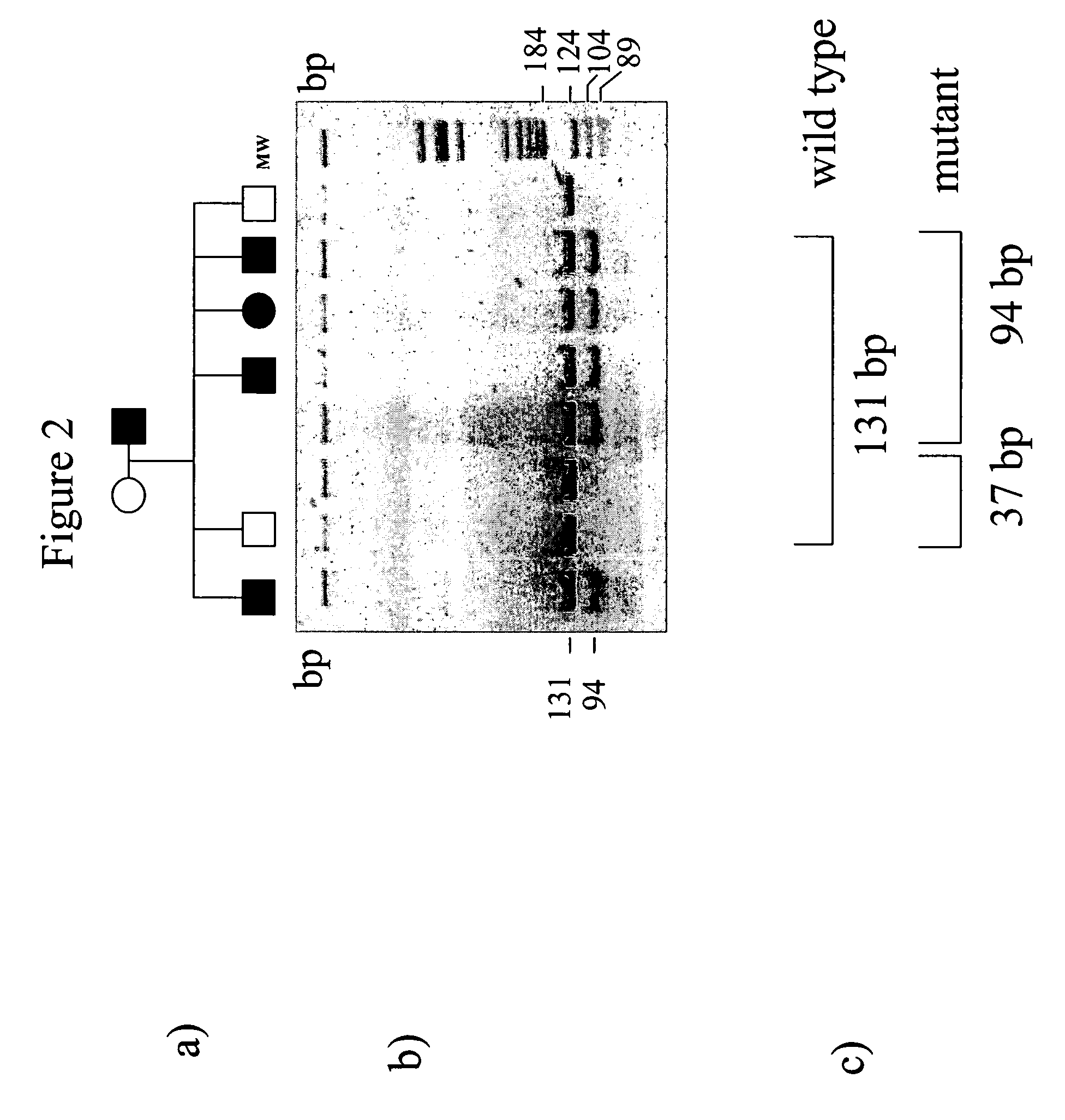 Mutations in the ferroportin 1 gene associated with hereditary haemochromatosis