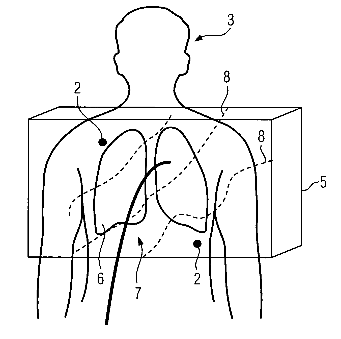 Method for localizing a medical instrument introduced into the body of an examination object