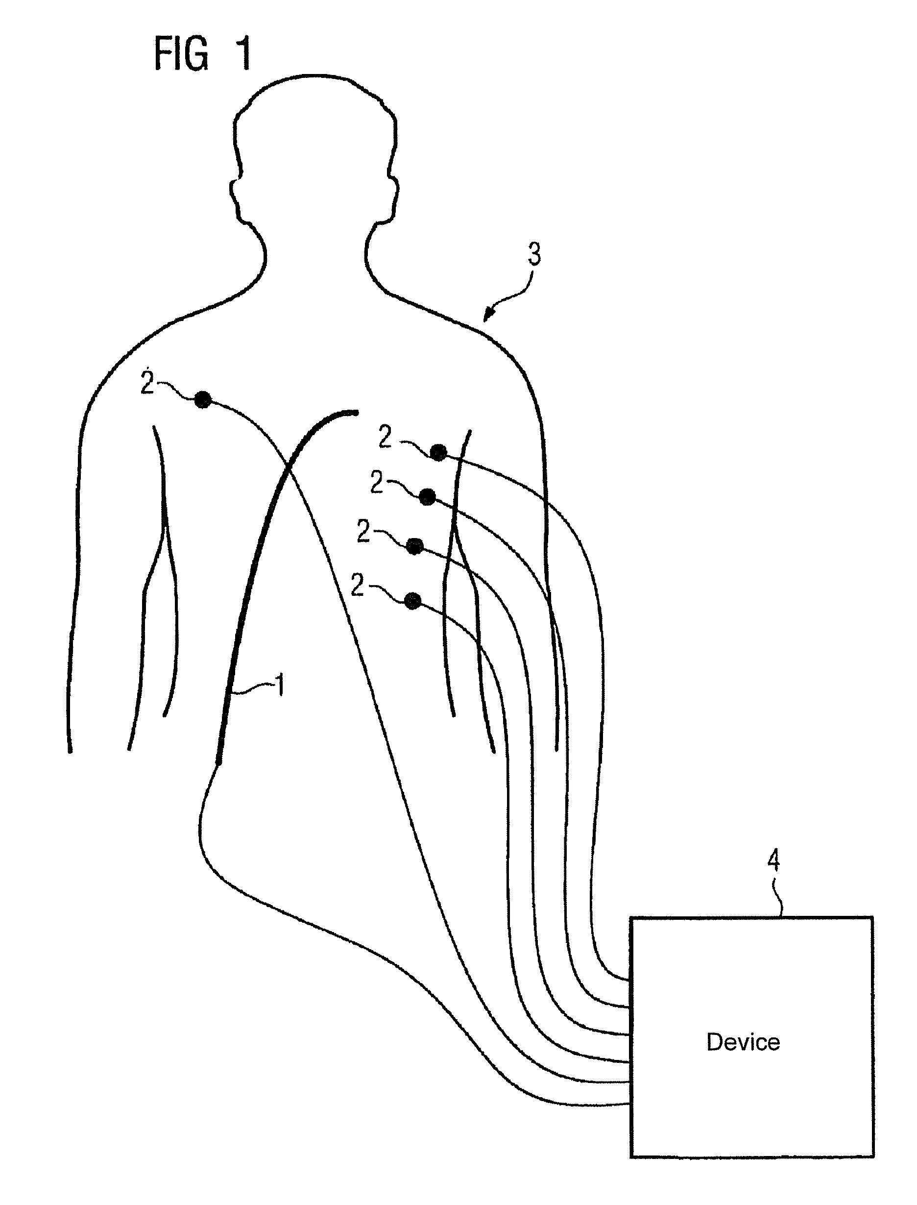 Method for localizing a medical instrument introduced into the body of an examination object