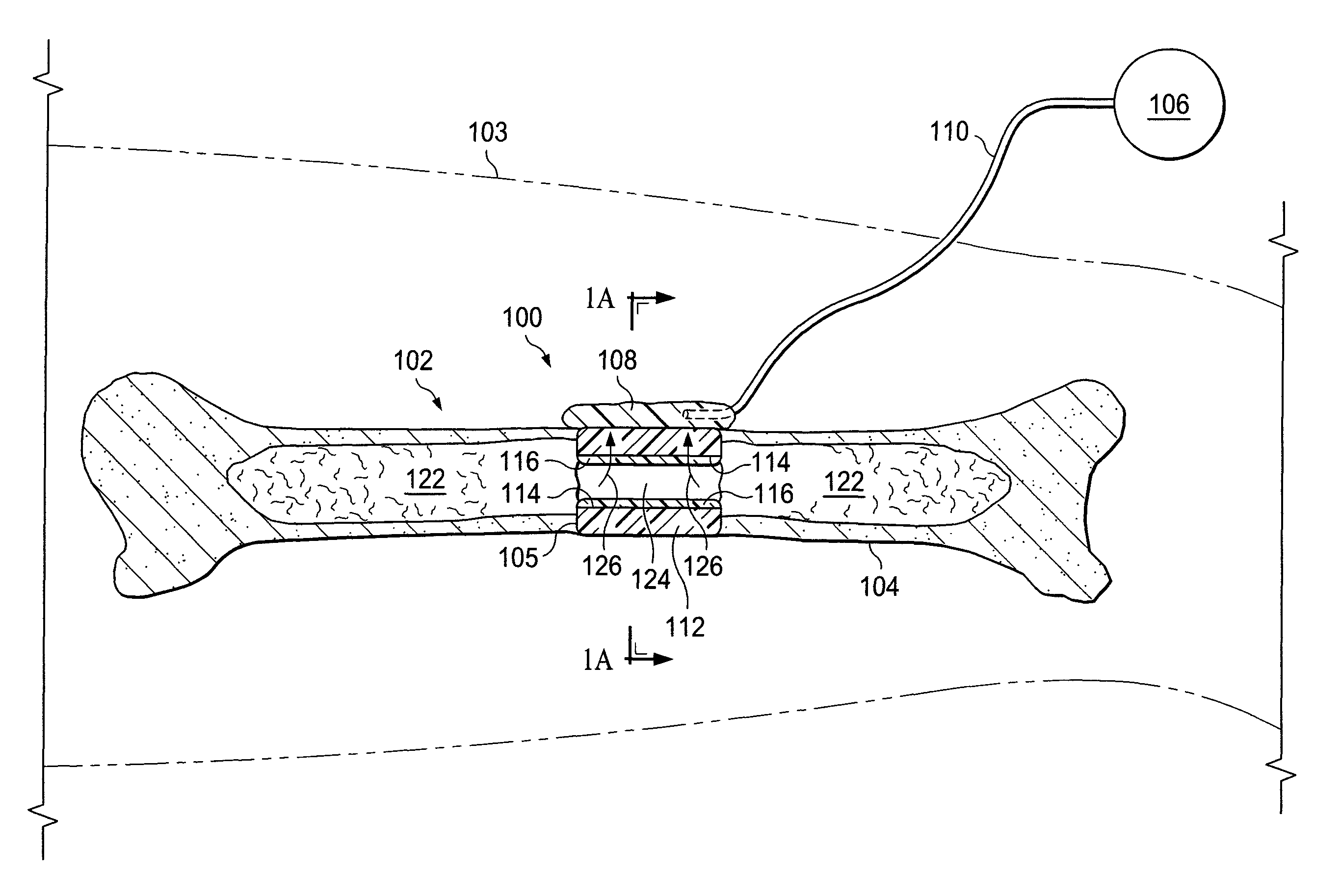 Systems for providing fluid flow to tissues