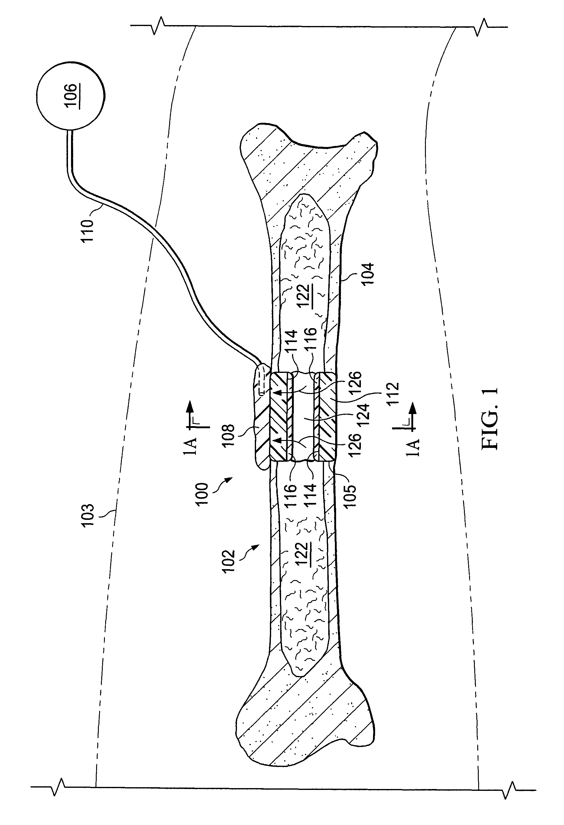 Systems for providing fluid flow to tissues