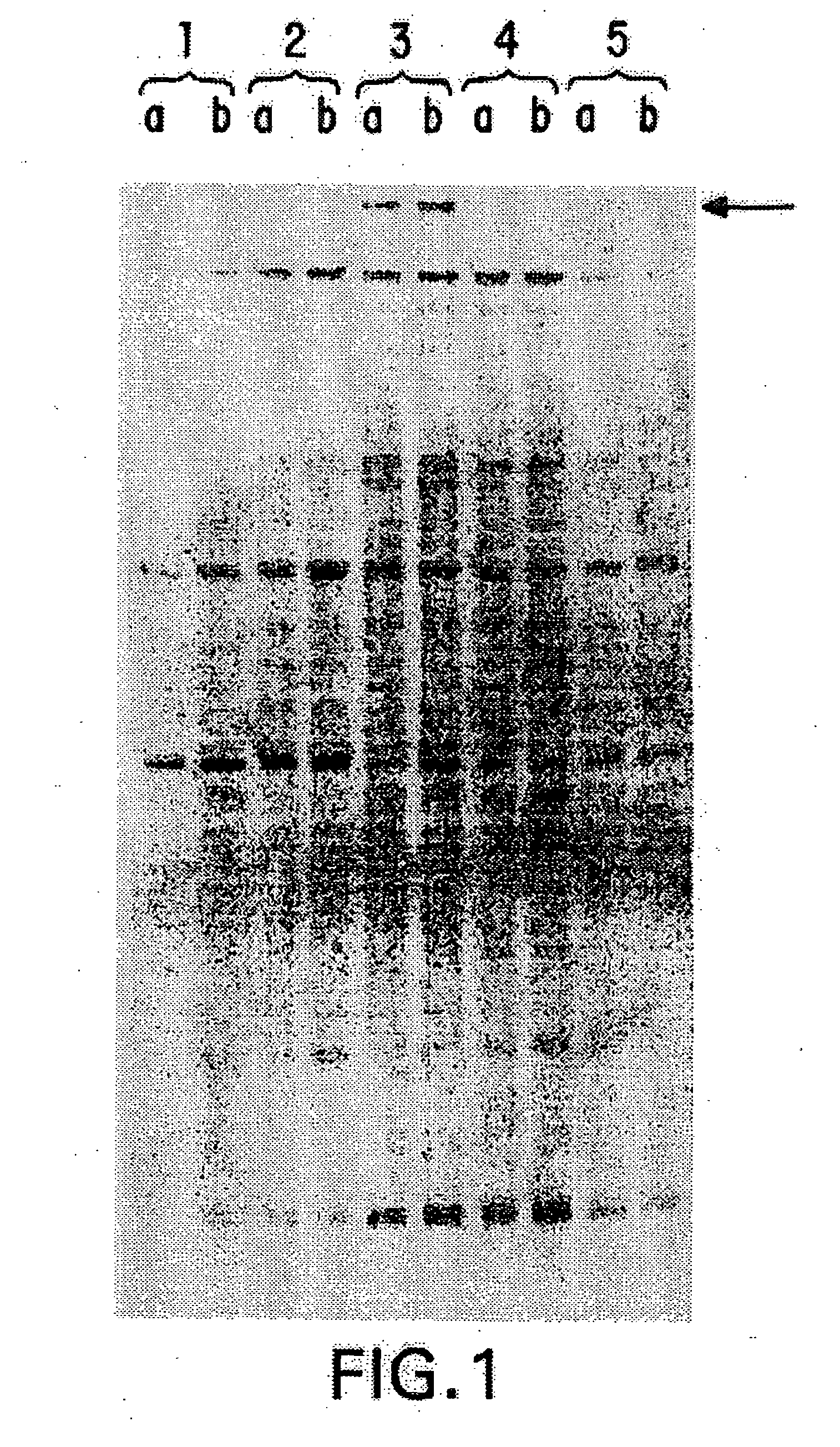 Compositions and methods for the treatment and diagnosis of immune disorders