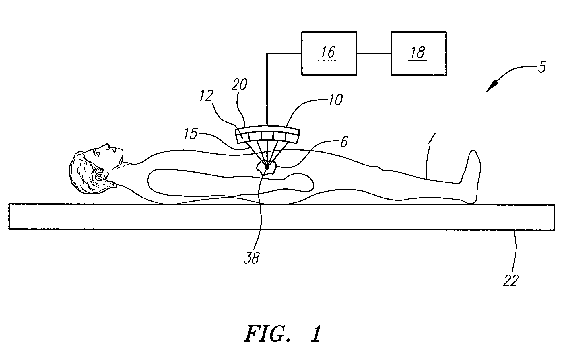 Focused ultrasound system with adaptive anatomical aperture shaping