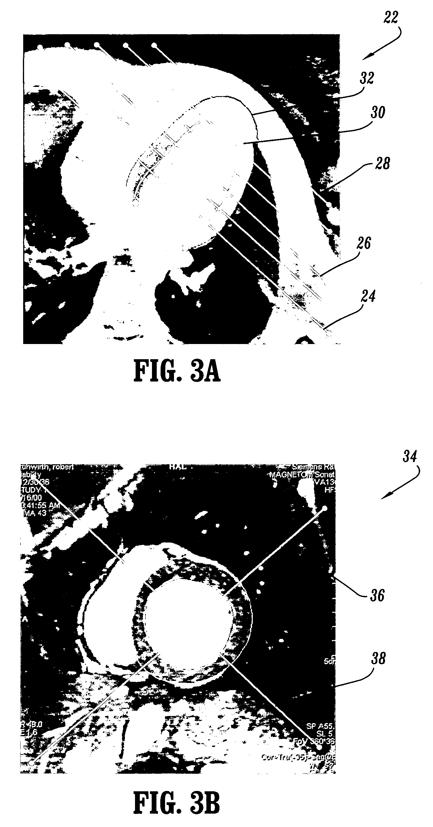 System and method for spatio-temporal guidepoint modeling