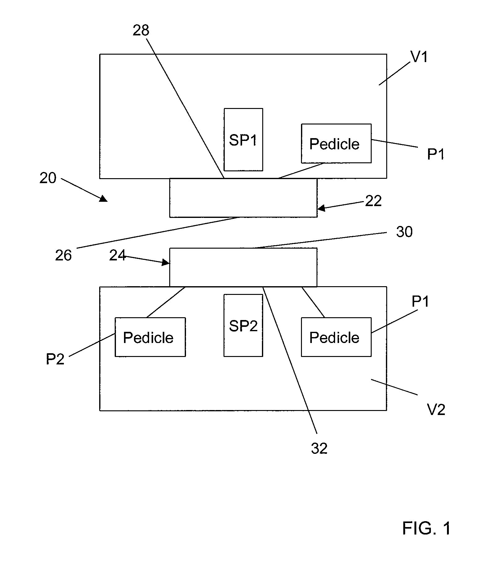 Spinous-process implants and methods of using the same
