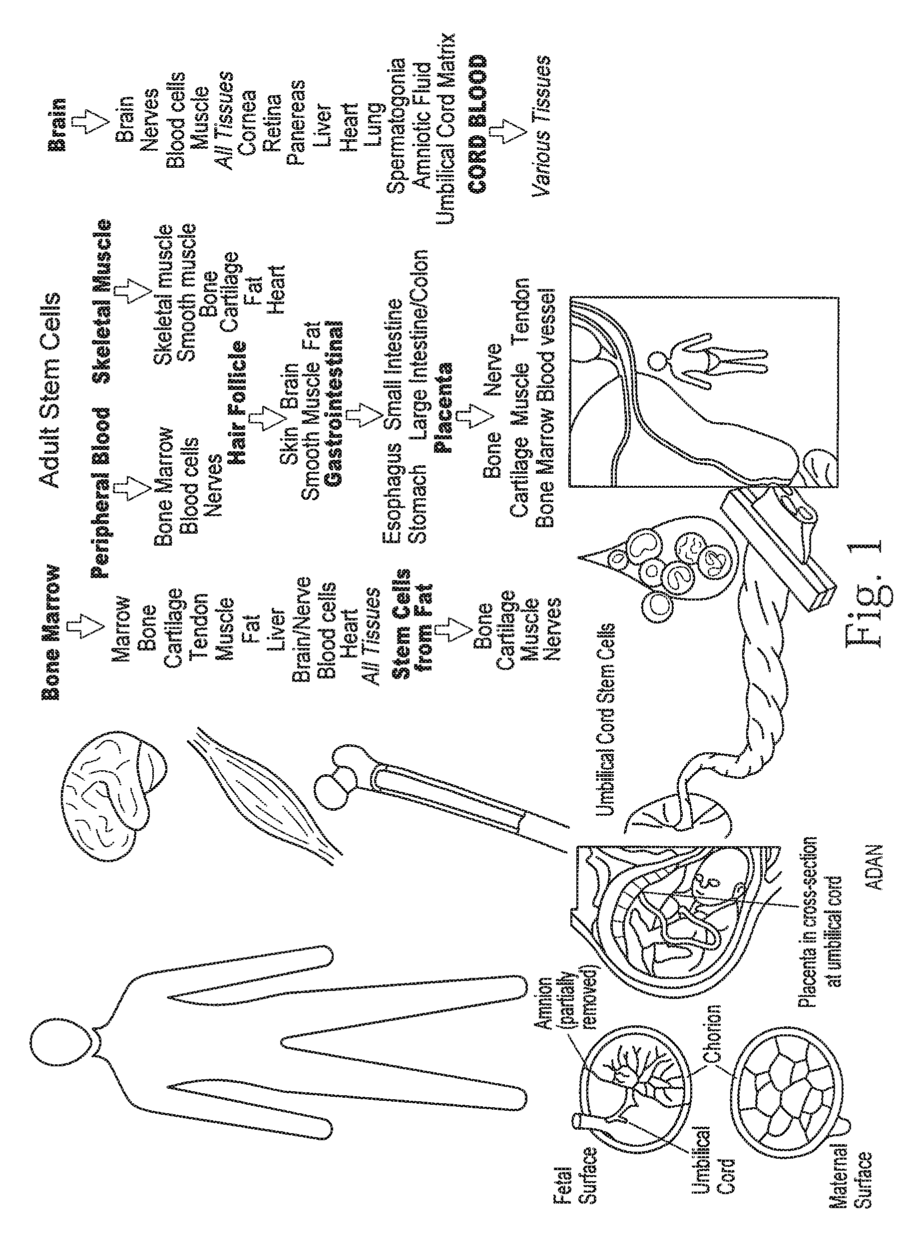 Methods of treating diseases or conditions using mesenchymal stem cells