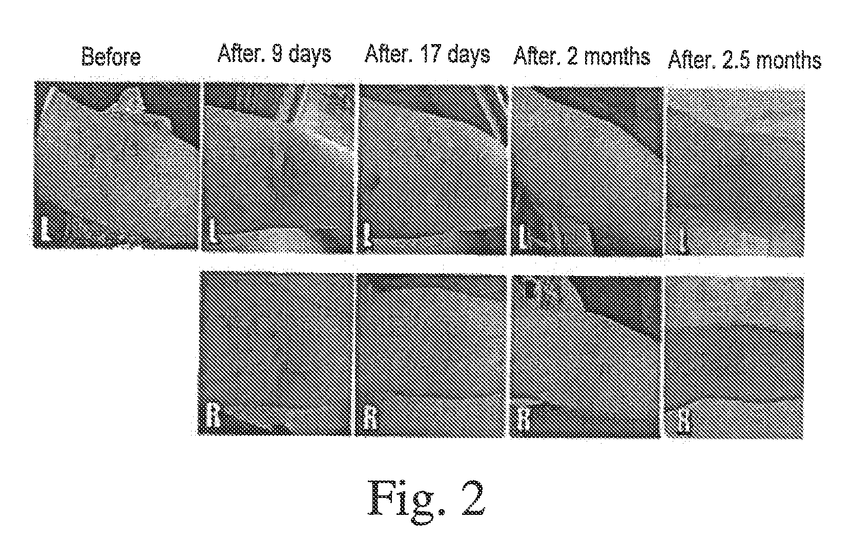 Methods of treating diseases or conditions using mesenchymal stem cells