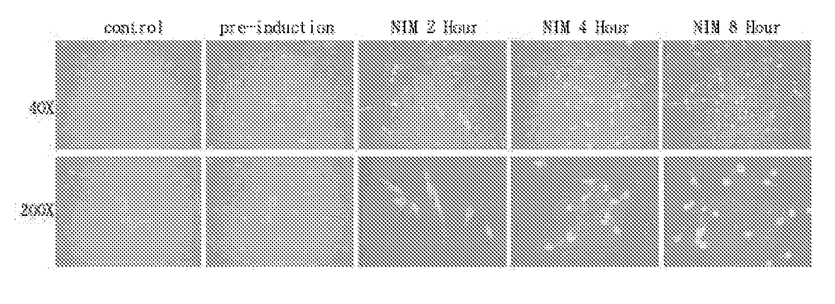 Method of inducing differentiation of mesenchymal stem cells into neurons
