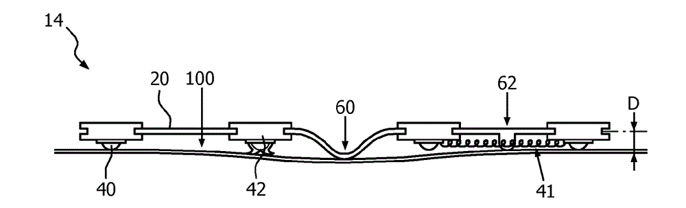 Light treatment system