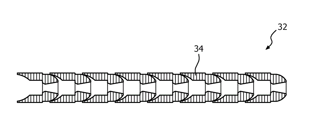 Light treatment system