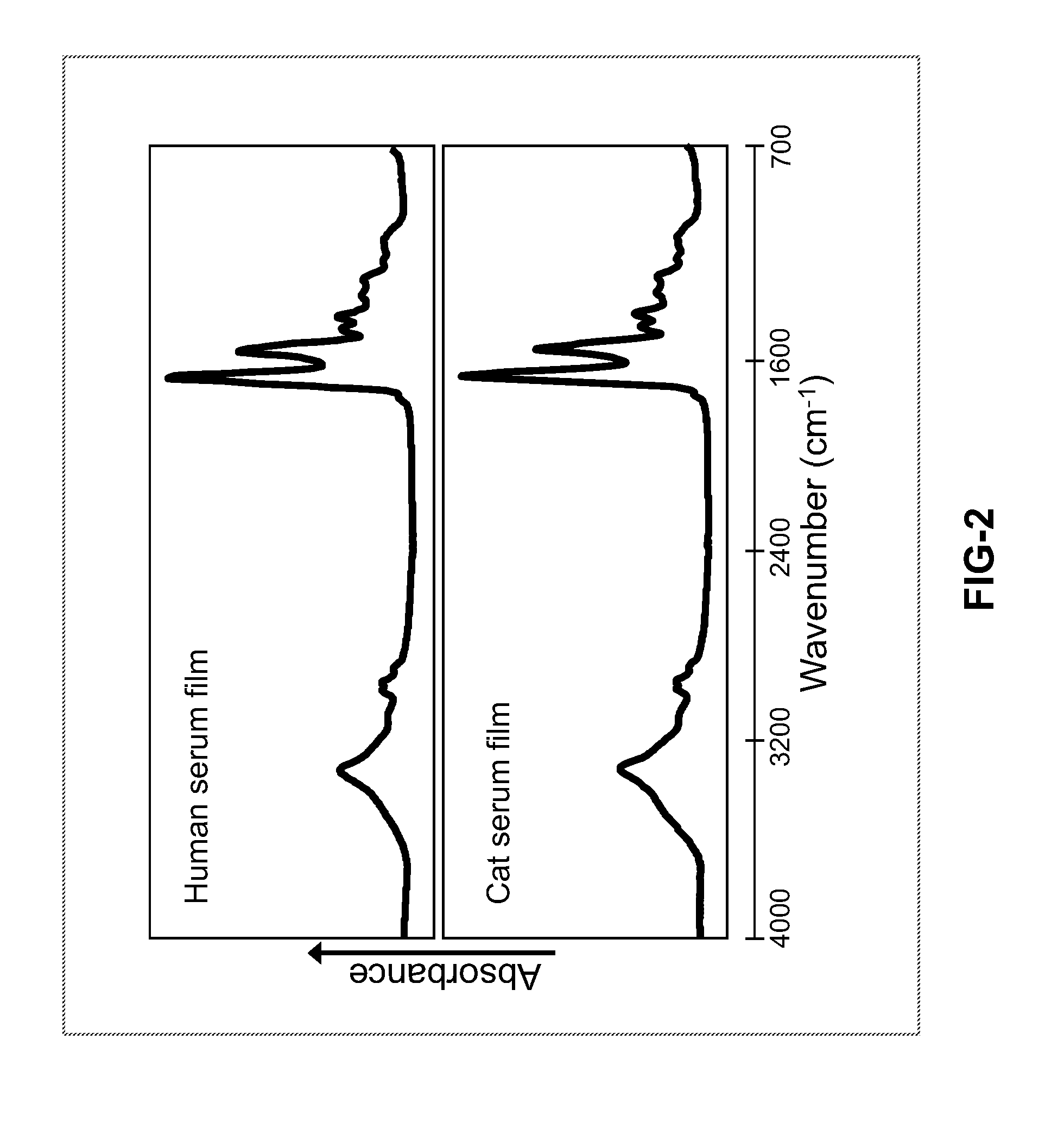 Rapid diagnosis of a disease condition using infrared spectroscopy