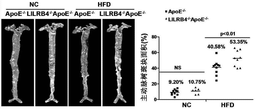 Function and application of white cell immune globulin toll-like receptor subfamily B member 4 in treatment of atherosclerosis