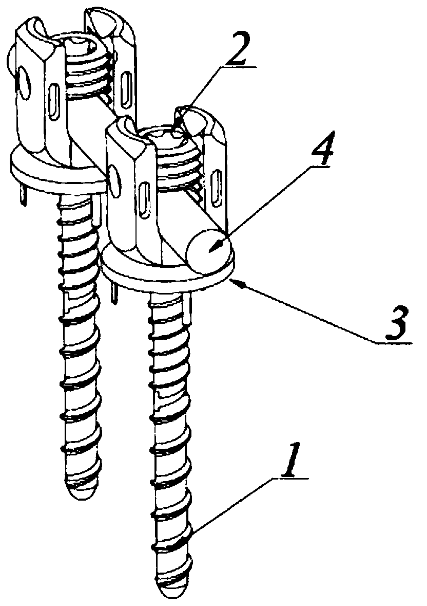 Thoracolumbar spine anterior system