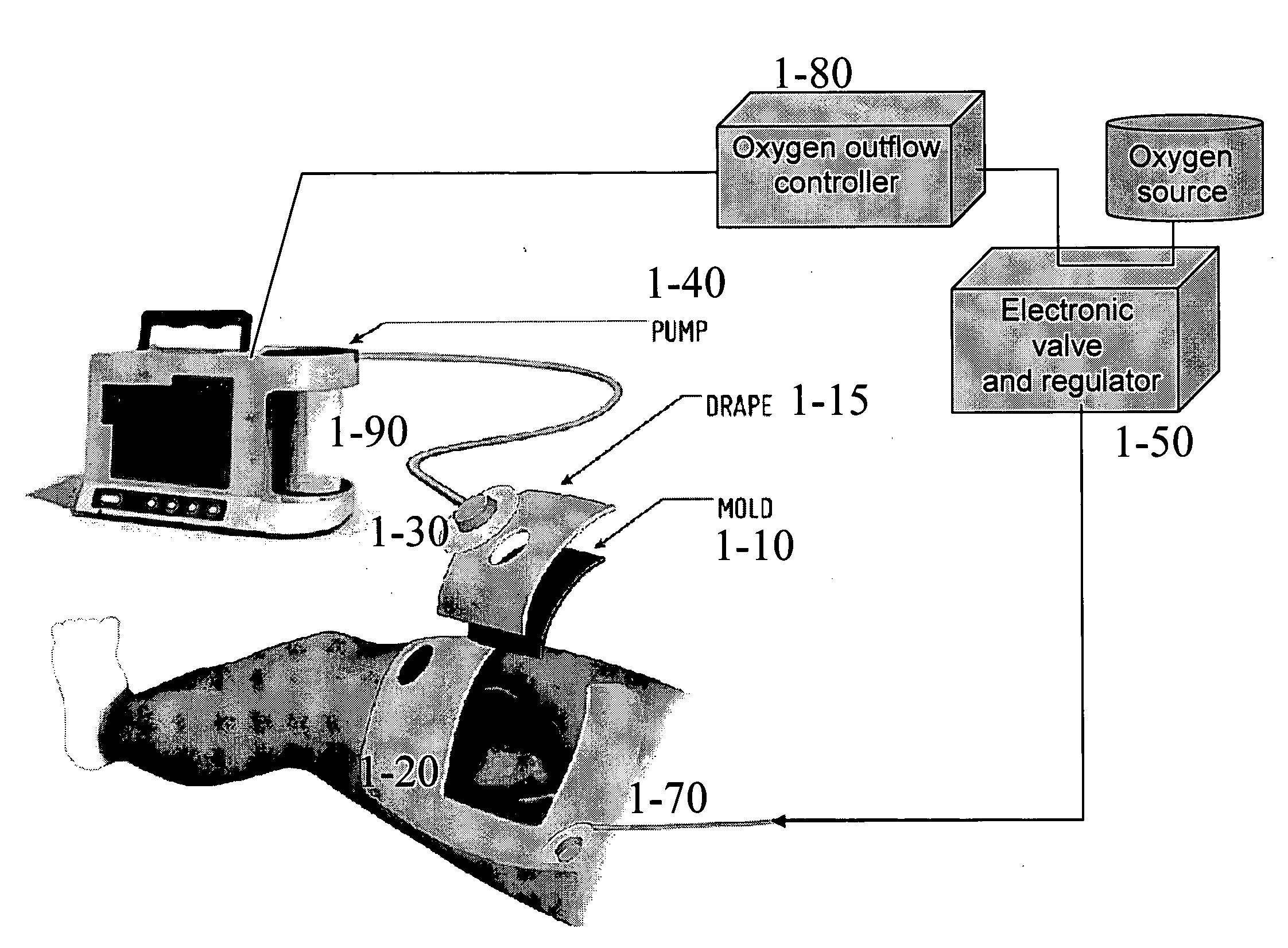 Wound healing device