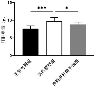 Application of bacteroides vulgarus probiotic CGMCC NO.17140 in preparation of lipid-lowering medicine